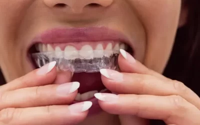 Invisalign Toluca Lake: Clear Aligner Therapy for Discreet Orthodontic Correction